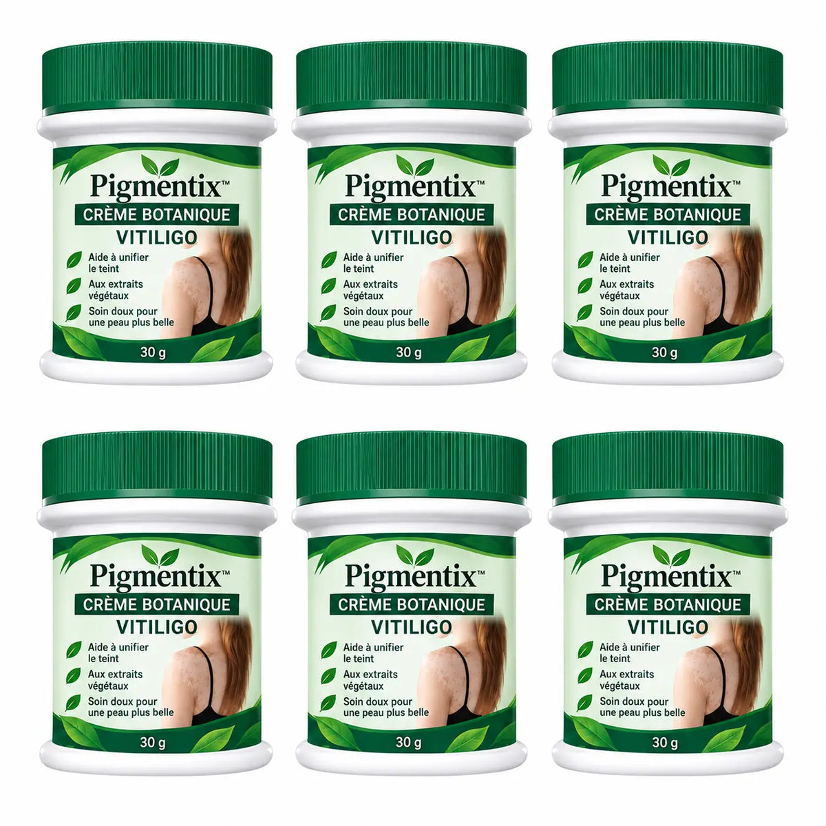 Pigmentix™ Crème Botanique Vitiligo | Réduisez l’apparence des taches blanches et retrouvez un teint plus uniforme sans maquillage épais !