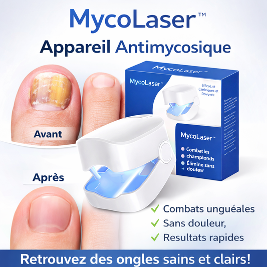 MycoLaser™ Appareil Antimycosique | Élimine 98 % des champignons des ongles en seulement 72 heures !