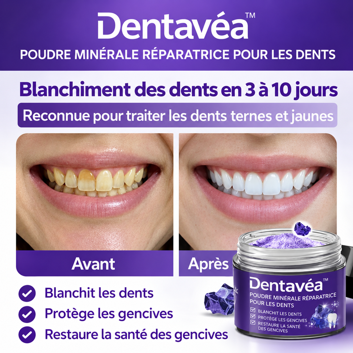 Dentavéa™ Poudre Minérale Réparatrice pour les Dents | Stoppez les saignements et refixez vos dents naturellement !