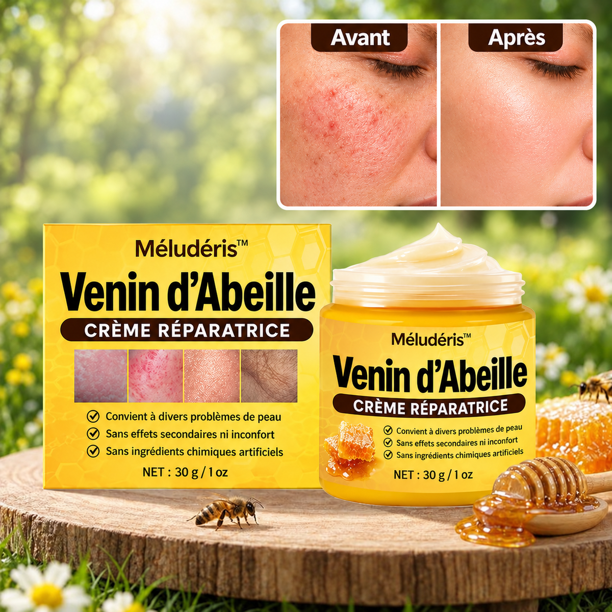 Méludéris™ Crème Réparatrice au Venin d’Abeille | Efface rougeurs & imperfections en 3 jours!