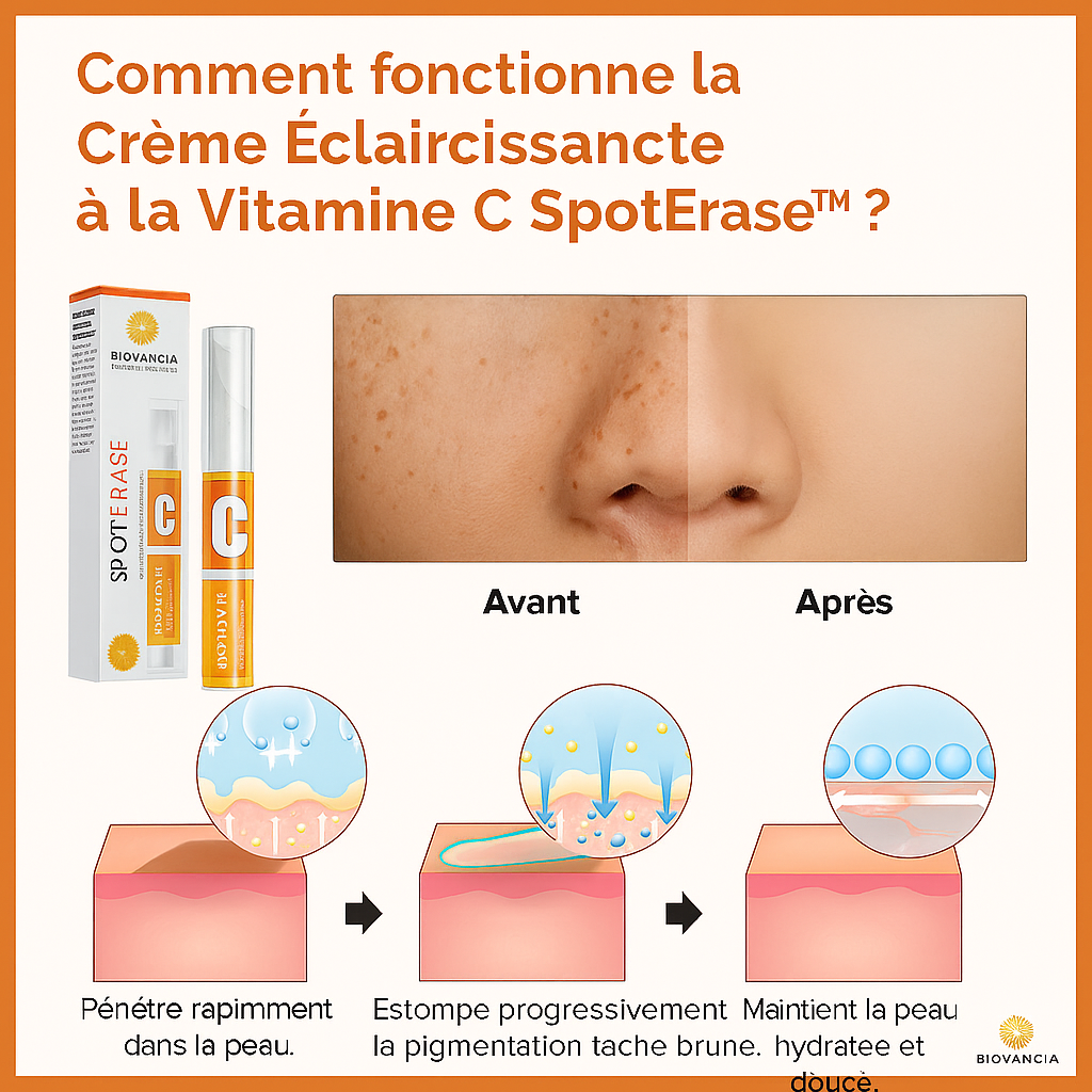 SpotErase™ Crème Éclaircissante à la Vitamine C | Élimine les taches et illumine votre teint en 10 minutes!