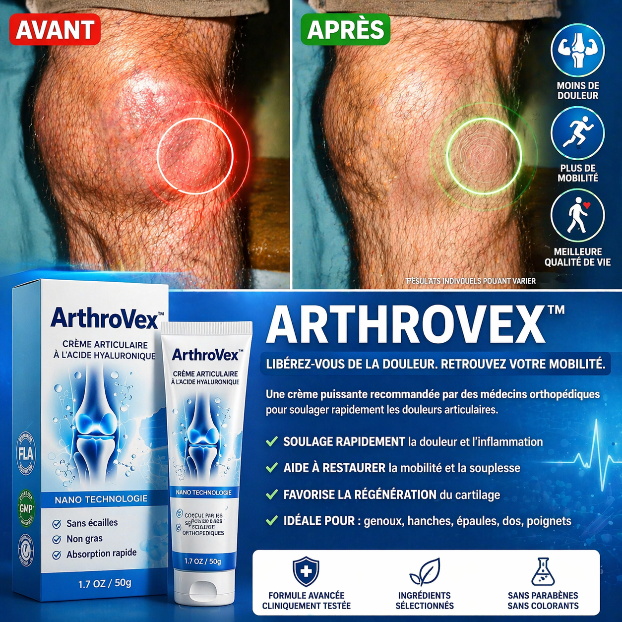 ArthroVex™ Crème Articulaire à l’Acide Hyaluronique | Soulagez vos douleurs en 60 secondes !