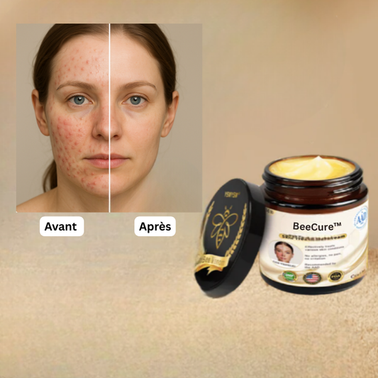 BeeCure™ Crème Régénérante au Venin d’Abeille | Répare votre peau en 24 heures!