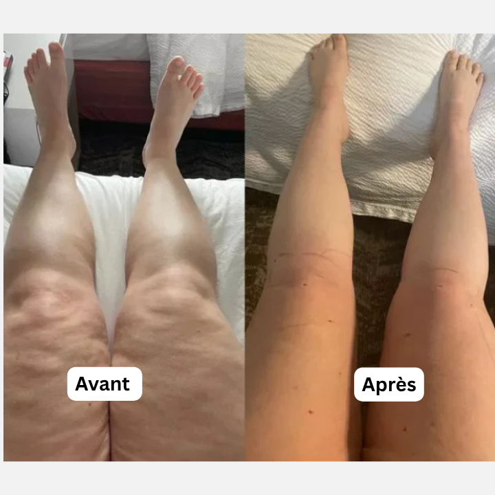 Lipoderm™ Slimming Patch with GLP-1