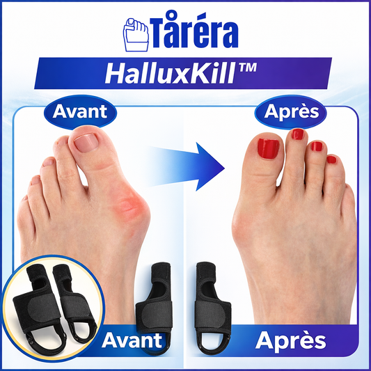 HalluxKill™ Correcteur Orthopédique | Redresse votre orteil et éliminez la douleur en seulement 14 jours !