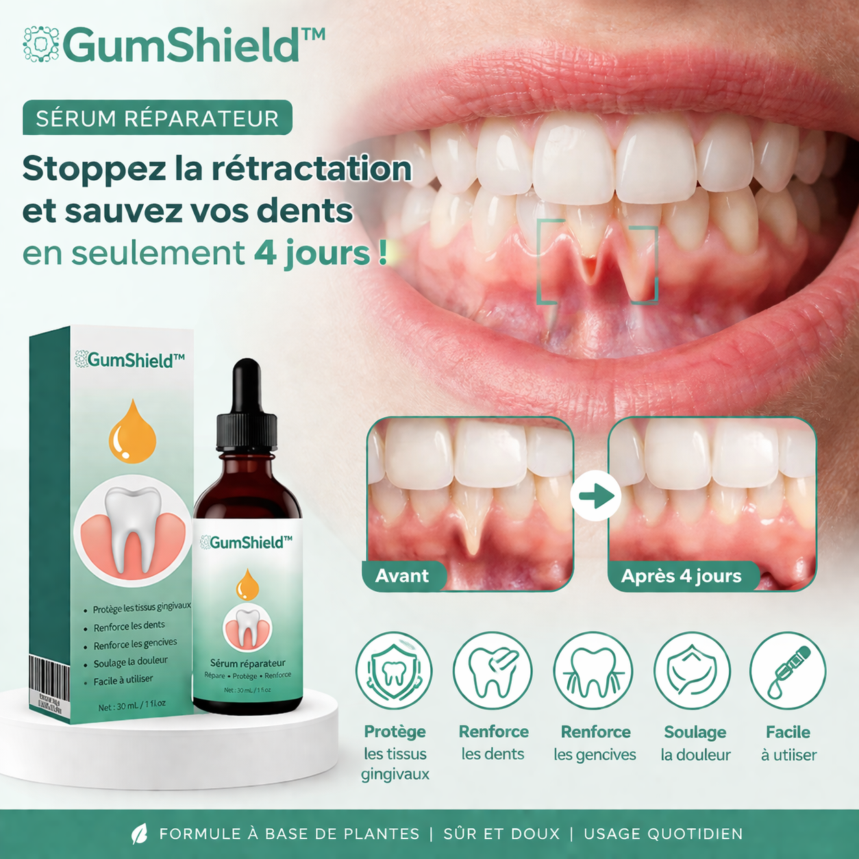 GumShield™ Sérum Réparateur | Stoppez la rétractation et sauvez vos dents en seulement 4 jours !