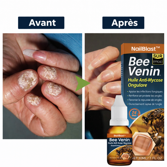 NailBlast™ Huile Réparatrice | Éliminez les ongles abîmés et retrouvez des ongles parfaits en seulement 3 minutes !