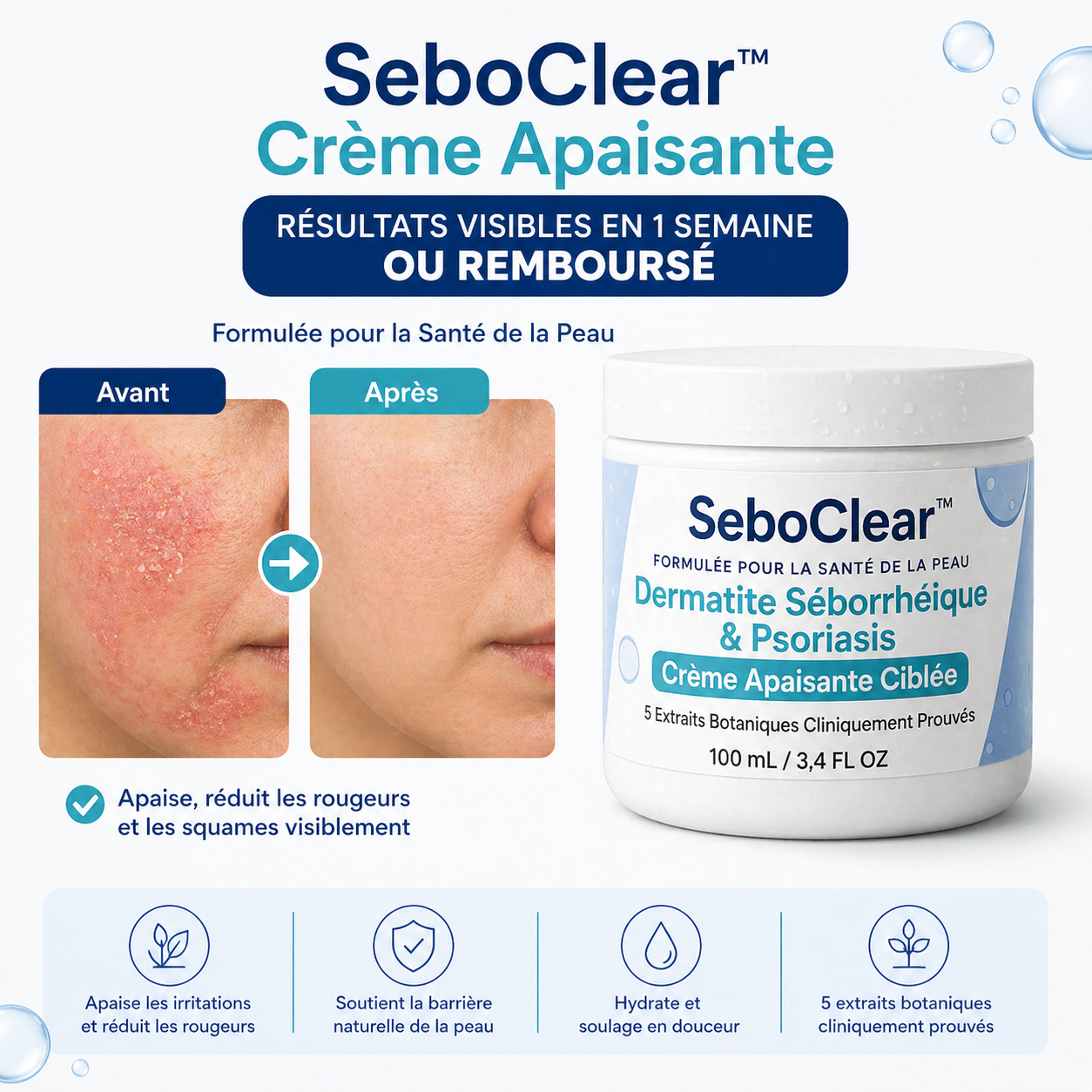 SeboClear™ Crème Apaisante | Éliminez les pellicules et les démangeaisons dès la première application !