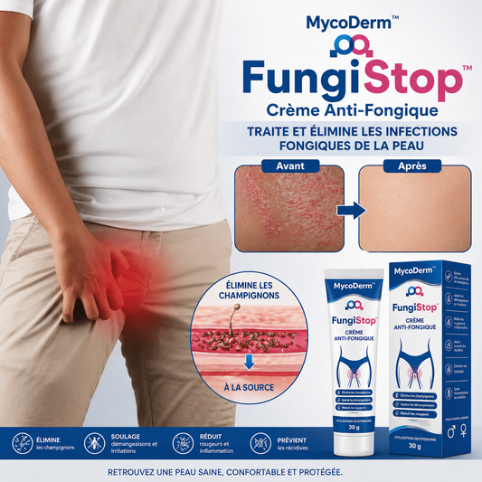 FungiStop™ Crème Anti-Fongique | Détruisez 97% des mycoses et démangeaisons en 48 heures chrono !
