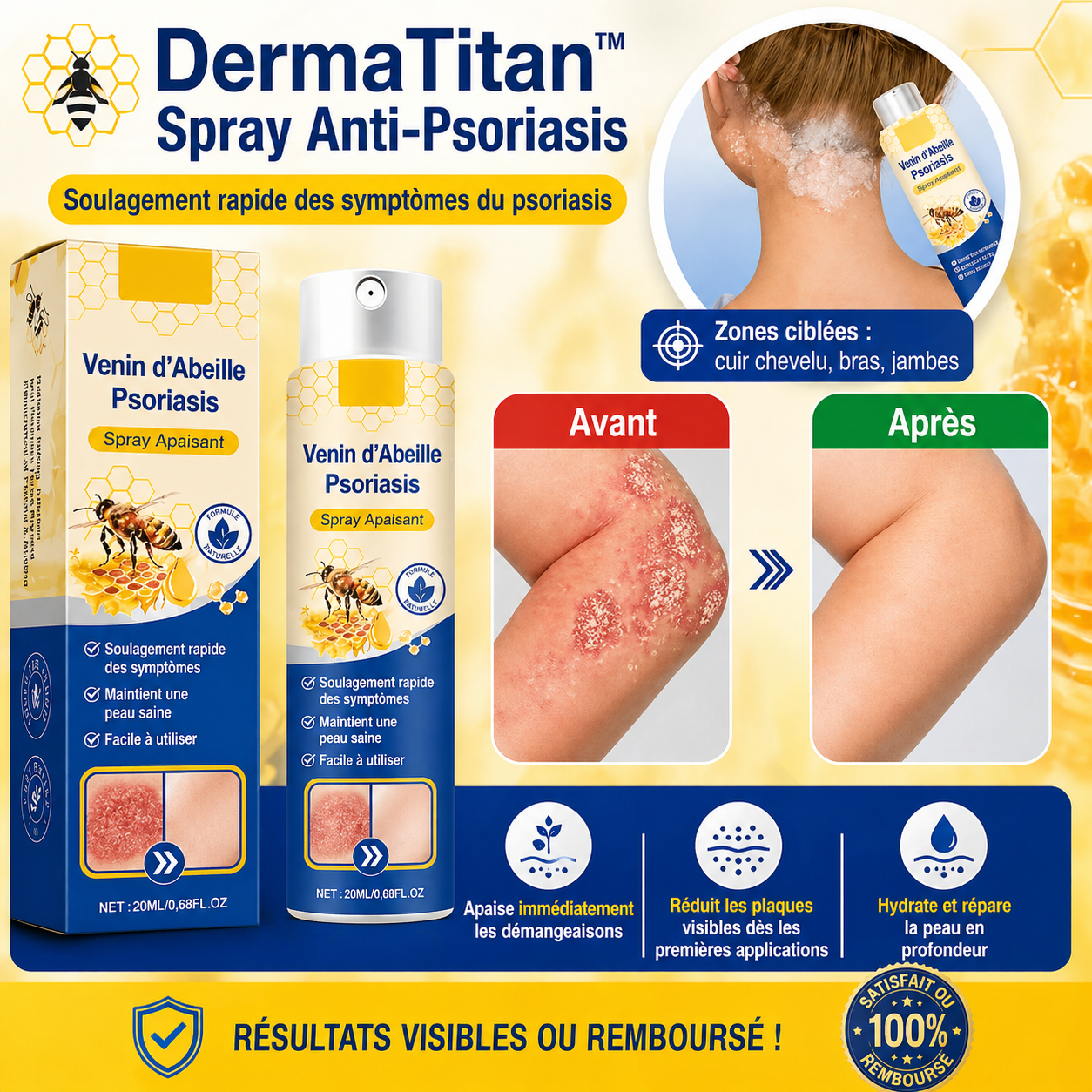DermaTitan™ Spray Anti-Psoriasis | Réduit jusqu’à 95 % des plaques et démangeaisons en quelques semaines !