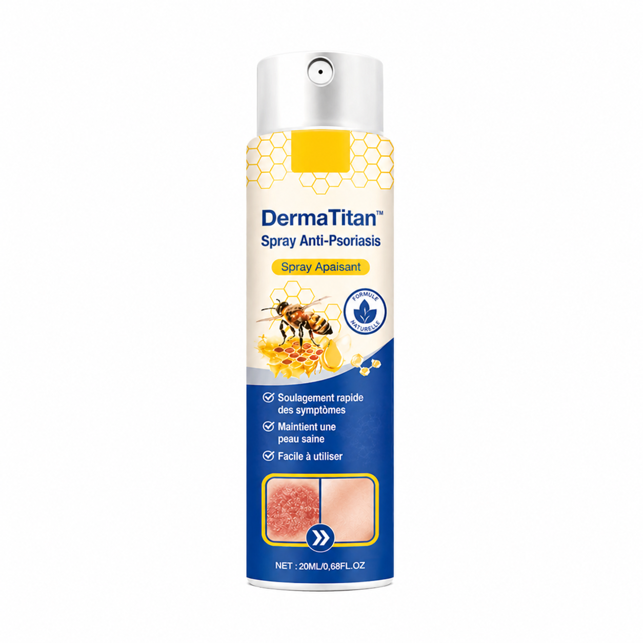 DermaTitan™ Spray Anti-Psoriasis | Réduit jusqu’à 95 % des plaques et démangeaisons en quelques semaines !