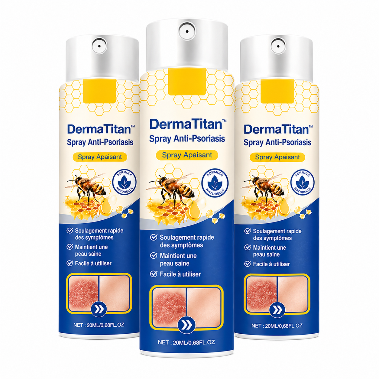 DermaTitan™ Spray Anti-Psoriasis | Réduit jusqu’à 95 % des plaques et démangeaisons en quelques semaines !