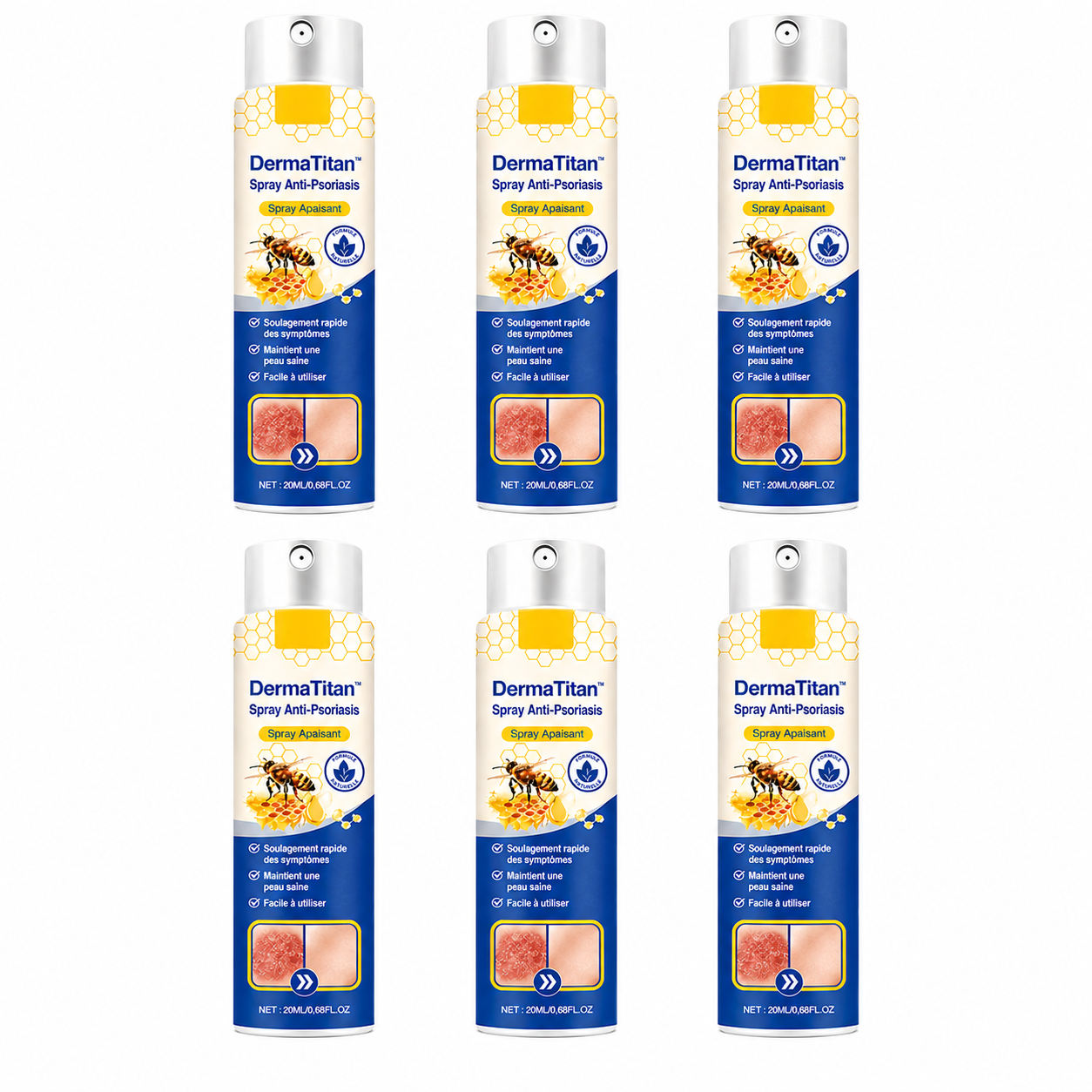 DermaTitan™ Spray Anti-Psoriasis | Réduit jusqu’à 95 % des plaques et démangeaisons en quelques semaines !