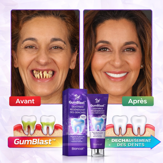 GumBlast™ Dentifrice Réparateur | Répare vos gencives et sauvez vos dents en seulement 3 minutes !