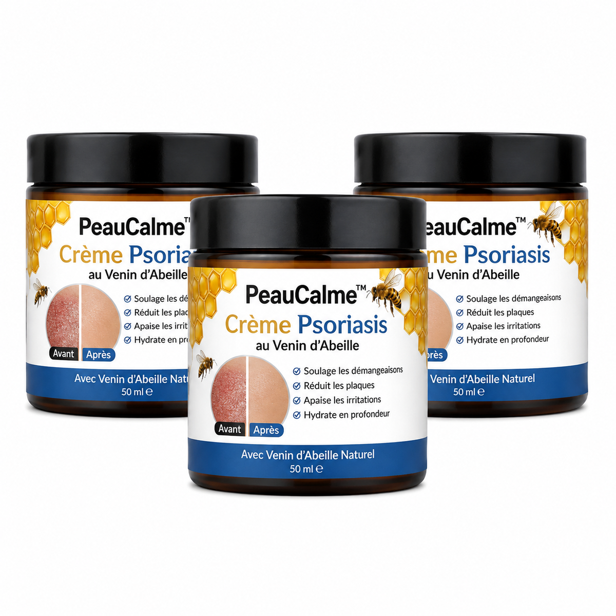 PeauCalme™ Crème Psoriasis au Venin d’Abeille | Stoppez les démangeaisons en 60 secondes, sans cortisone !