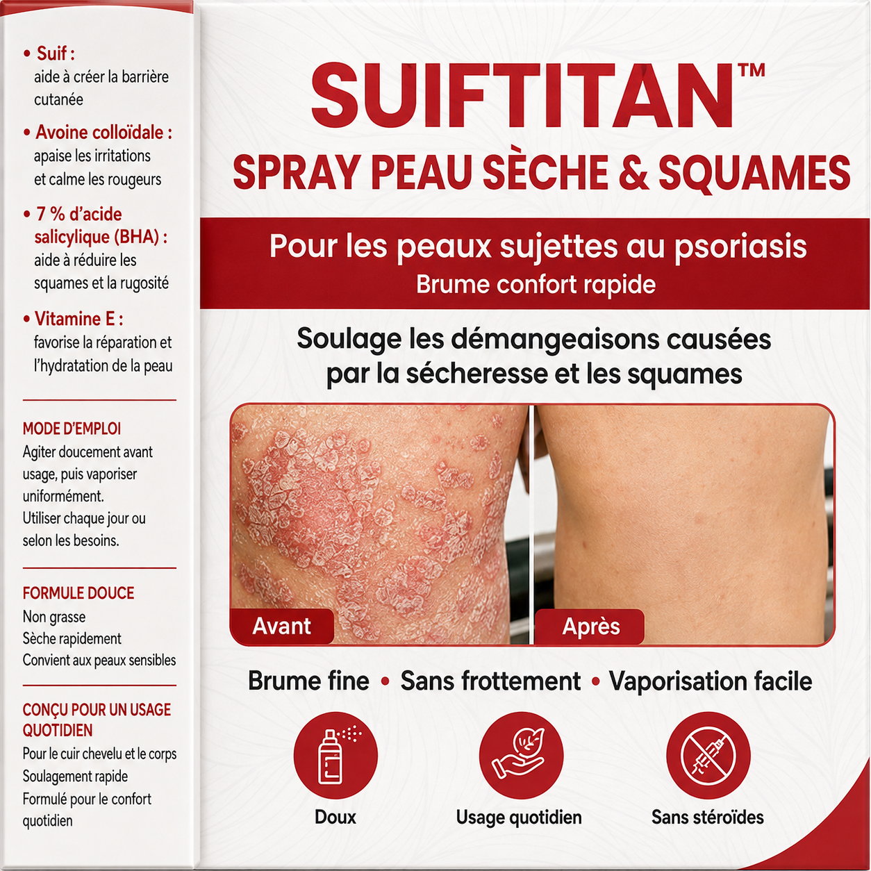 SuifTitan™ Spray Peau Sèche & Squames | Pulvérisez, apaisez, retrouvez une peau douce en 30 secondes !
