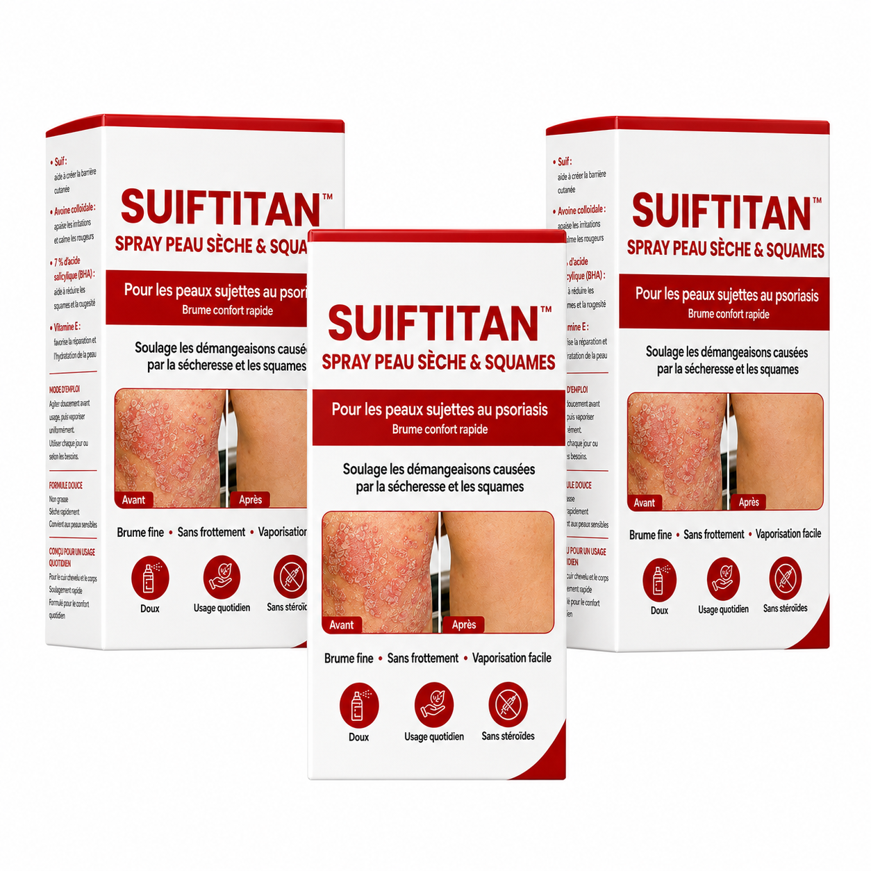 SuifTitan™ Spray Peau Sèche & Squames | Pulvérisez, apaisez, retrouvez une peau douce en 30 secondes !