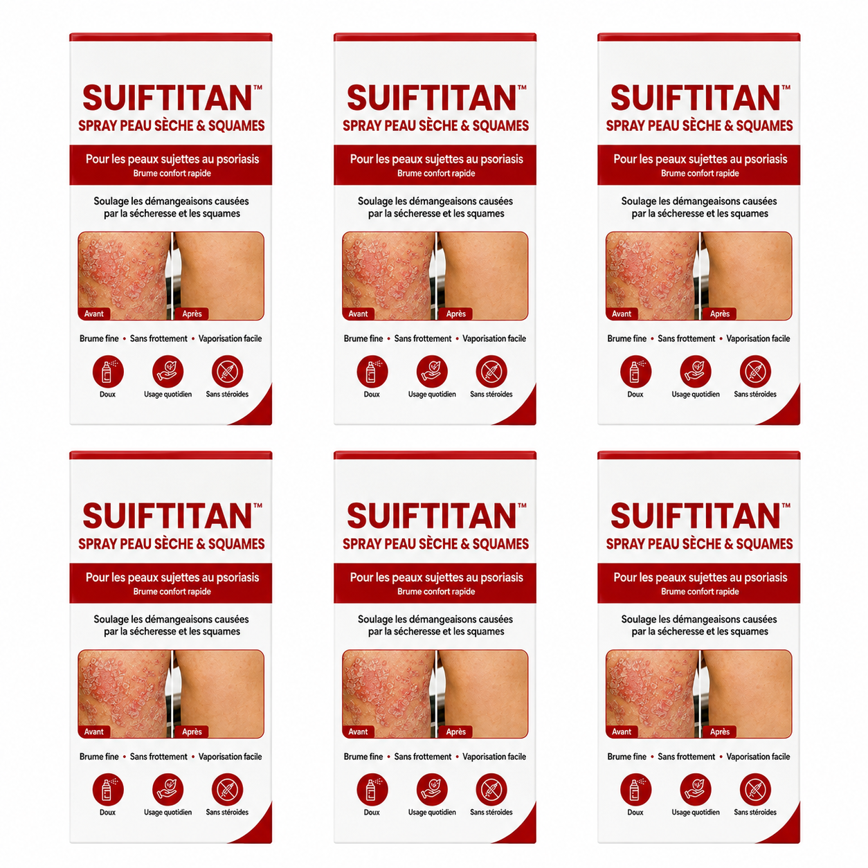 SuifTitan™ Spray Peau Sèche & Squames | Pulvérisez, apaisez, retrouvez une peau douce en 30 secondes !