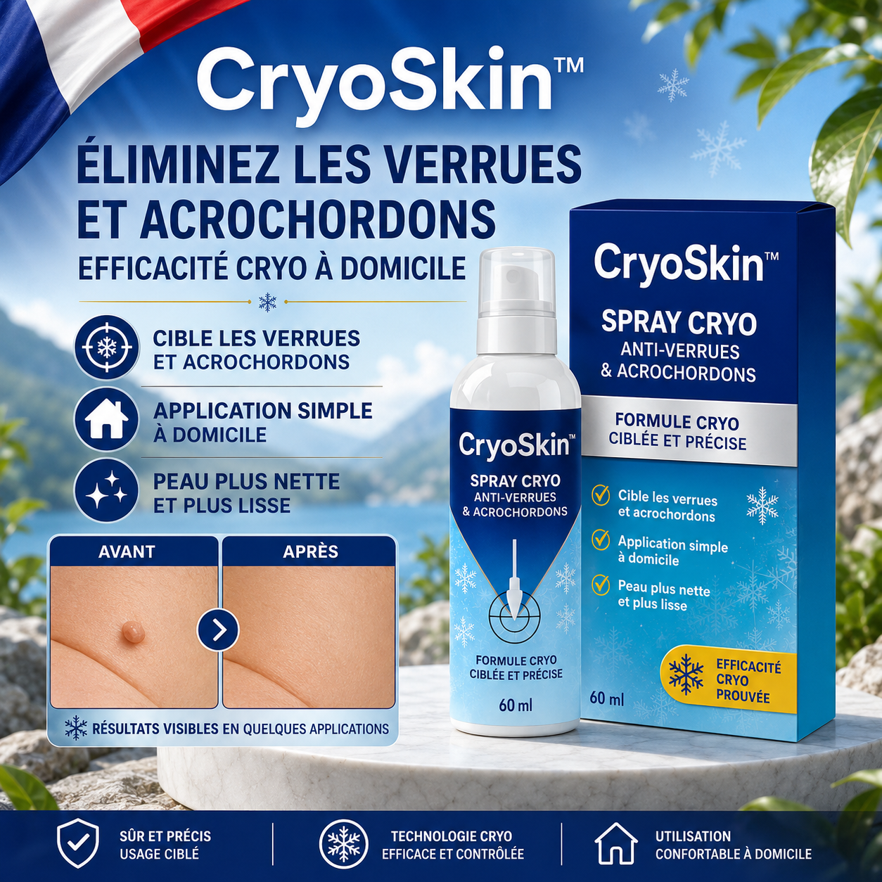 CryoSkin™ Spray Cryo Anti-Verrues & Acrochordons | Supprimez verrues, acrochordons et zones rugueuses depuis chez vous !