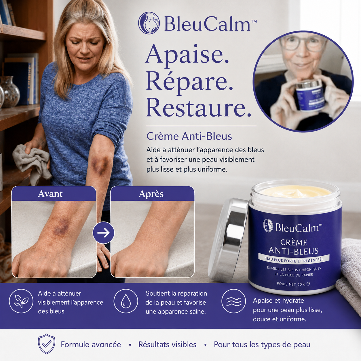 BleuCalm™ Crème Anti-Bleus | Éliminez 97 % des bleus persistants et de la peau parcheminée en 36 heures !