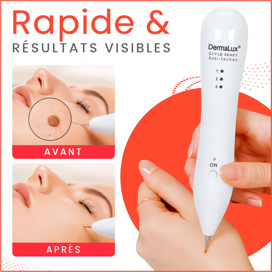 DermaLux™ Stylo Laser Anti-taches | Élimine les problèmes de peau en 3 minutes!