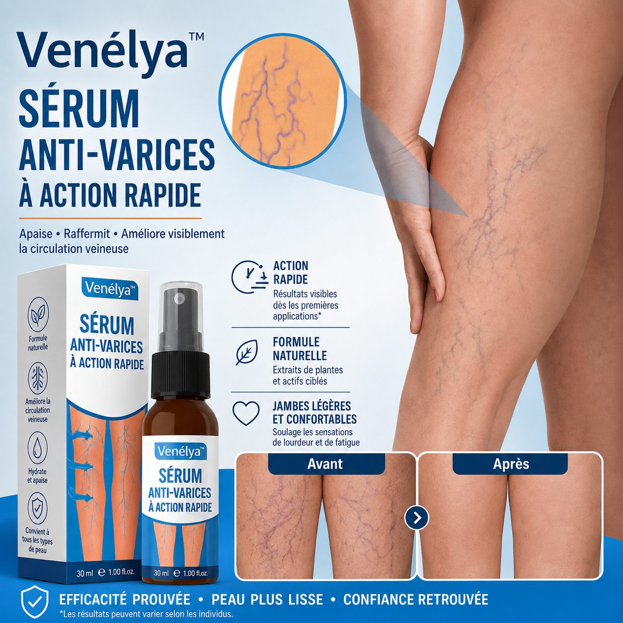 Venélya™ Sérum Anti-Varices à Action Rapide | Élimine 95% des varices visibles en 4 jours!