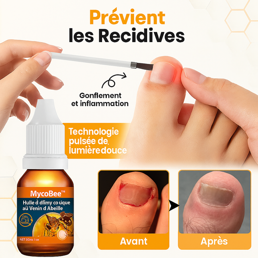 MycoBee™ Huile Antimycosique au Venin d’Abeille | Éradique les mycoses dès la 1ère application!