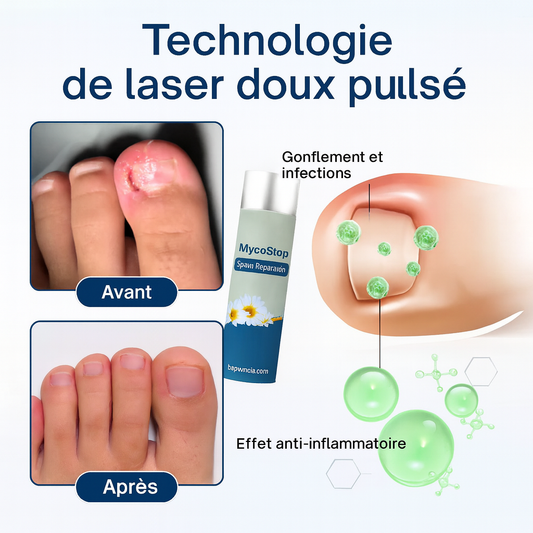 MycoStop™ Spray Réparateur | Élimine les mycoses et répare les ongles en 7 jours!