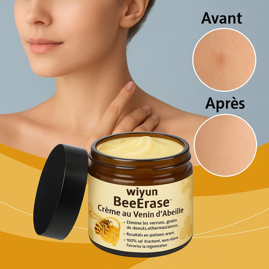 BeeErase™ Crème au Venin d’Abeille | Élimine verrues, grains de beauté & excroissances en quelques jours !