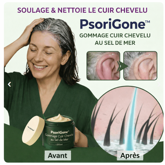 PsoriGone™ Gommage Cuir Chevelu au Sel de Mer | Éradiquez la psoriasis du crâne en 3 jours, sans cortisone !