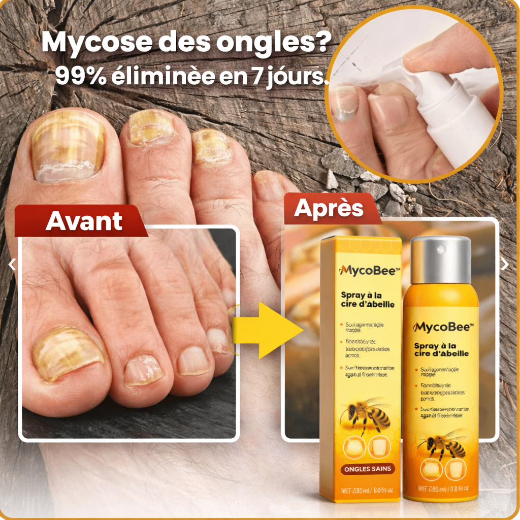 MycoBee™ Spray à la Cire d’Abeille | Éliminez 99 % des cas de mycose des ongles en seulement 7 jours !