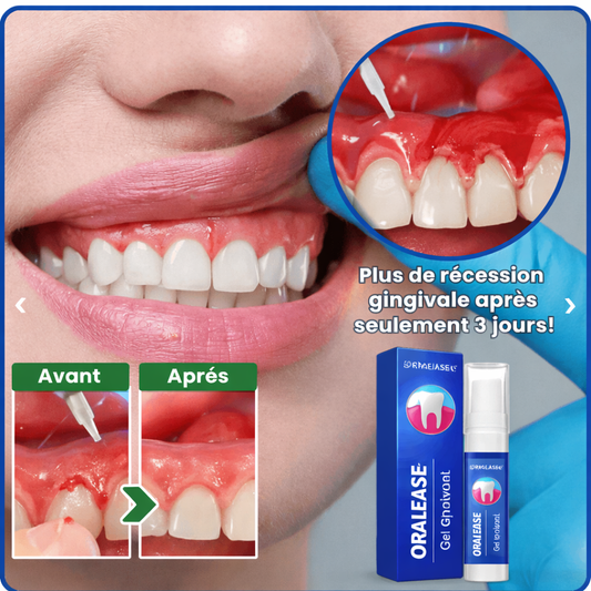 OralEase™ Gel Gingival | Plus de récession gingivale après seulement 3 jours !