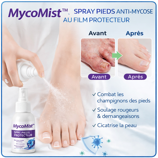 MycoMist™ Spray Pieds Anti-Mycose au Film Protecteur | Éliminez les champignons en 48h chrono !