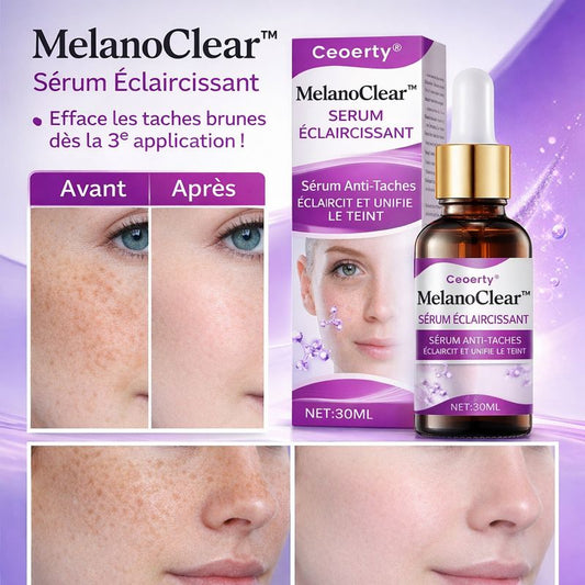 MelanoClear™ Sérum Éclaircissant | Efface les taches brunes dès la 3ᵉ application !
