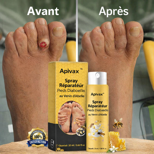 Apivax™ Spray Réparateur Pieds Diabétiques au Venin d’Abeille | Refermez les plaies et stoppez la douleur dès la première application !