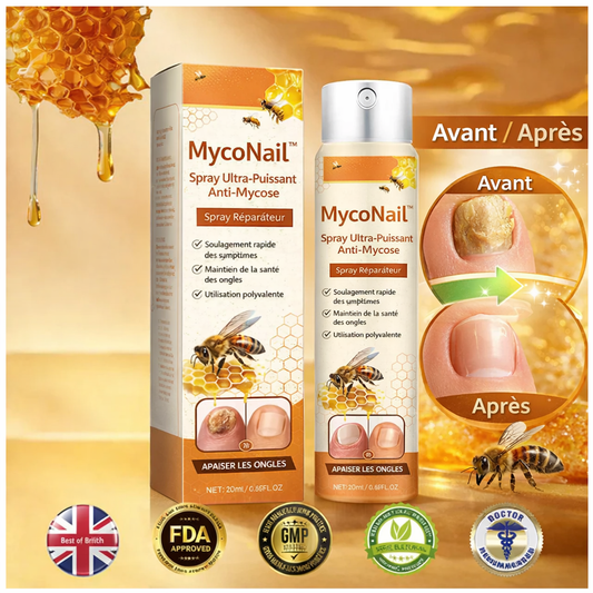 MycoNail™ Spray Ultra-Puissant Anti-Mycose | Élimine les champignons, répare vos ongles et les rend impeccables en 7 jours chrono