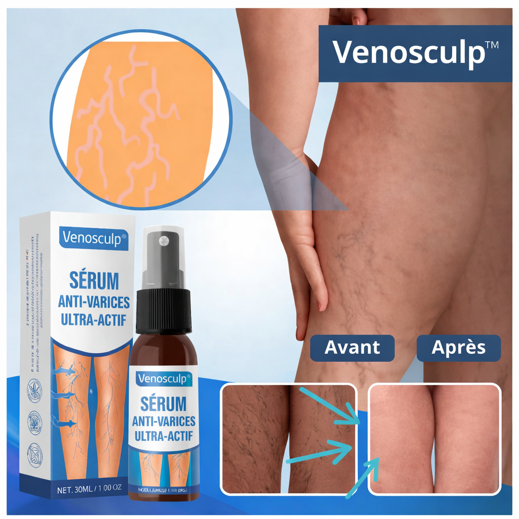 Venosculp™ Sérum Anti-Varices Ultra-Actif | Efface visiblement vos varices en 4 jours !