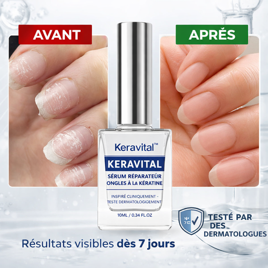 Keravital™ Sérum Réparateur Ongles à la Kératine | Des ongles plus forts et reconstruits dès la racine en 14 jours !