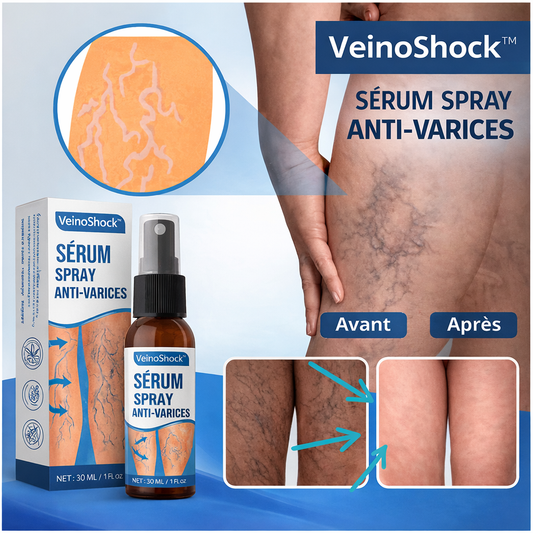 VeinoShock™ Sérum Spray Anti-Varices | Efface jusqu’à 95% des varices visibles en 4 jours chrono !
