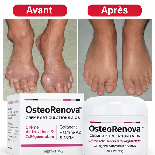OsteoRenova™ Crème Articulations & Os Régénératrice | Reconstruisez vos cartilages et éliminez la douleur en 3 minutes !