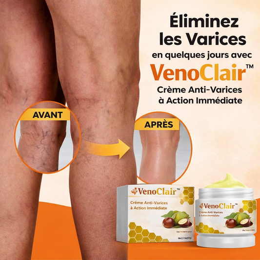 VenoClair™ Crème Anti-Varices à Action Immédiate | Faites disparaître vos varices en 3 minutes !