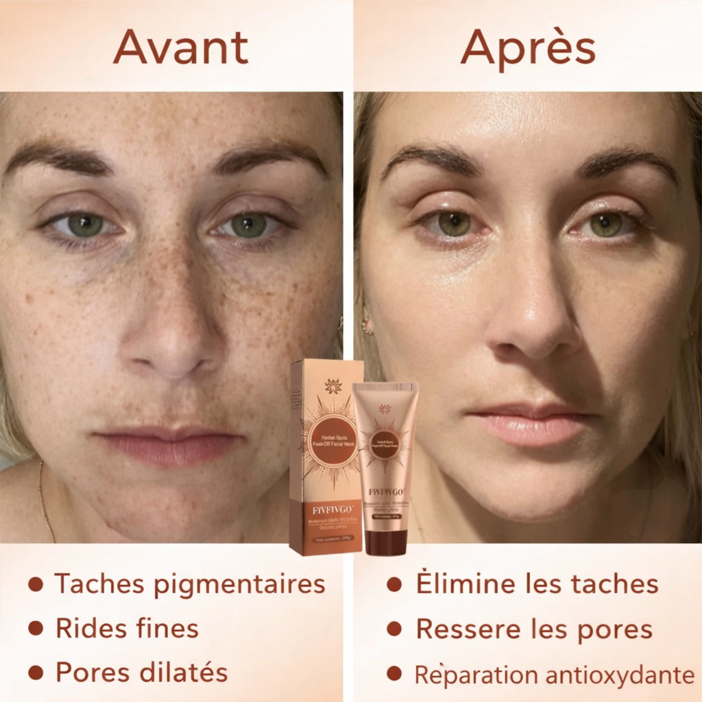 DERMASPOT™ Masque Peel-Off Anti-Taches aux Plantes | Effacez taches, points noirs et teint terne en 3 minutes !