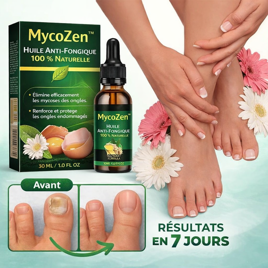 MycoZen™ Huile Anti-Fongique 100 % Naturelle | Détruisez les champignons en 7 jours !