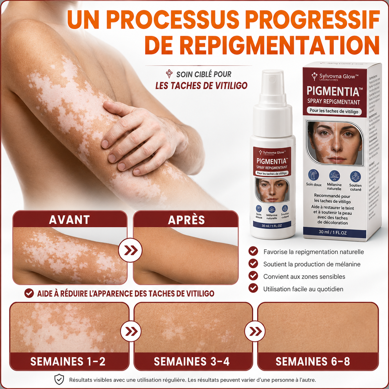 Pigmentia™ Spray Repigmentant | Réactivez votre pigmentation naturelle et atténuez les taches blanches en 4 semaines !