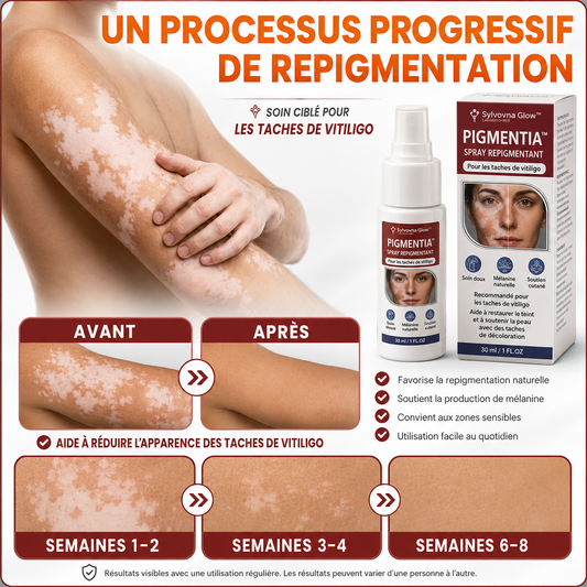 Pigmentia™ Spray Repigmentant | Réactivez votre pigmentation naturelle et atténuez les taches blanches en 4 semaines !