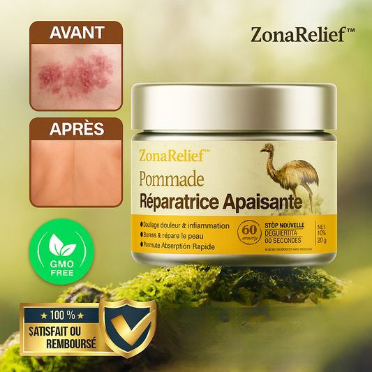 ZonaRelief™ Pommade Réparatrice Apaisante | Soulage les douleurs du zona et régénère la peau en 5 jours!