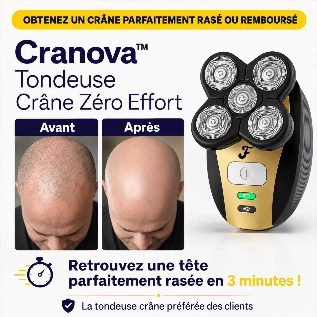 Cranova™ Tondeuse Crâne Zéro Effort | Retrouvez une tête parfaitement rasée en 3 minutes !