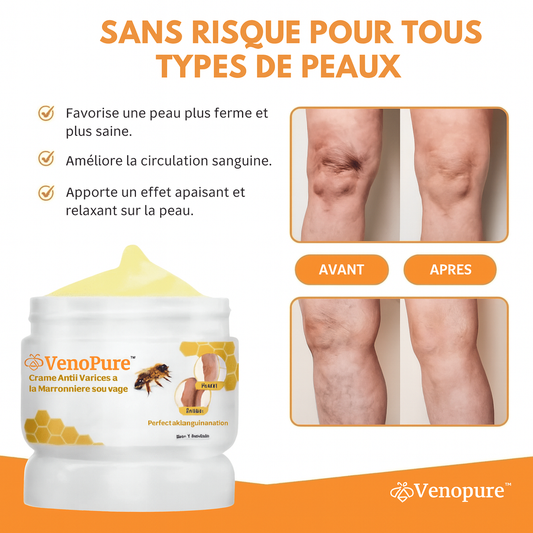 VenoPure™ Crème Anti-Varices à la Marronnière Sauvage | Fait disparaître les varices dès la 1ère application!