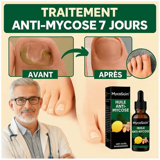MycoSoin™ Huile Anti-Mycose | Élimine les champignons des ongles en 7 jours chrono!