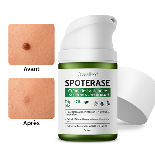 SpotErase™ Crème Instantanée Anti-Taches & Grains de Beauté | Élimine les imperfections cutanées en 10 minutes!